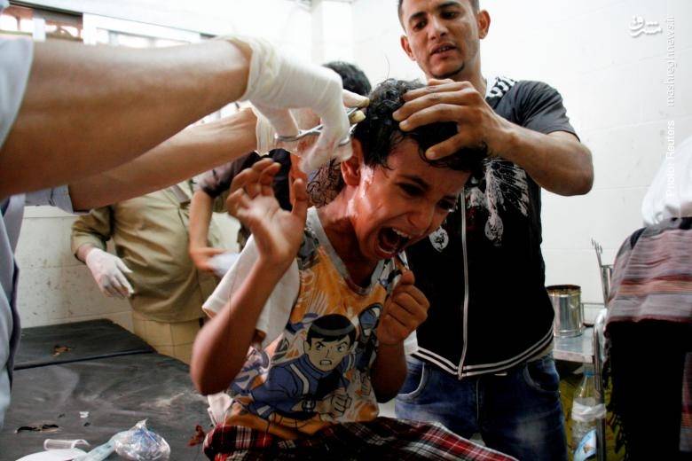 یکی از کودکان مجروح جنگ یمن