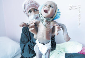 وبا یک میلیون نفر را در ۳ شهر یمن تهدید می‏‌کند
