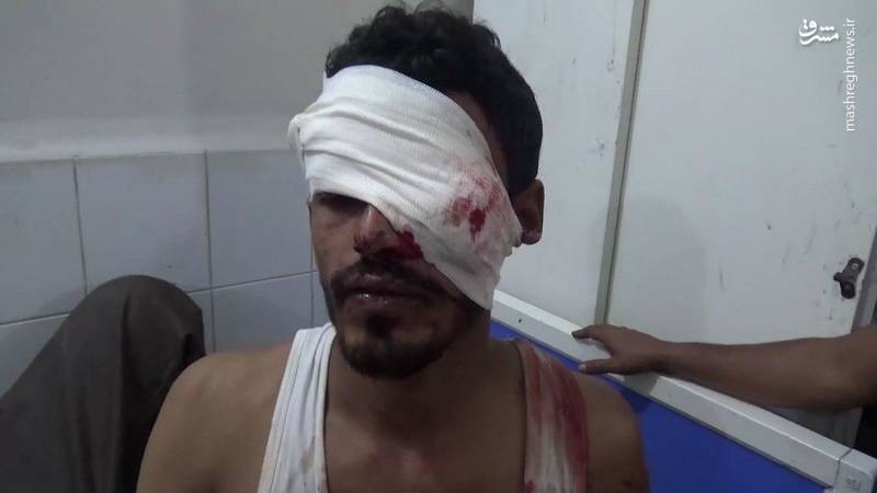 2157594 - 19 شهید و زخمی در بمباران بازاری در یمن+عکس