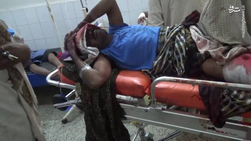 2157598 - 19 شهید و زخمی در بمباران بازاری در یمن+عکس