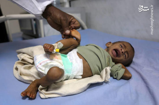 شیوع وبا در یمن «غیرقابل کنترل» می‌شود